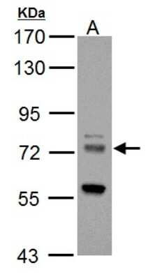 Western Blot: ZDHHC17 Antibody [NBP2-20941]