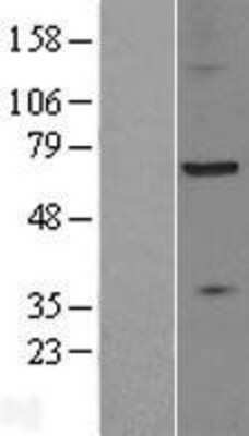 Western Blot: ZDHHC17 Overexpression Lysate [NBL1-18003]