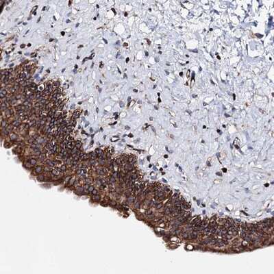 Immunohistochemistry-Paraffin: ZDHHC18 Antibody [NBP1-85057]