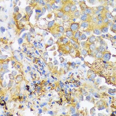 Immunohistochemistry-Paraffin: ZDHHC18 Antibody - Azide and BSA Free [NBP2-94111]