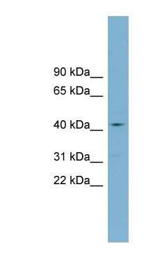 Western Blot: ZDHHC18 Antibody [NBP1-60124]