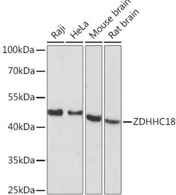 Western Blot: ZDHHC18 AntibodyAzide and BSA Free [NBP2-94111]