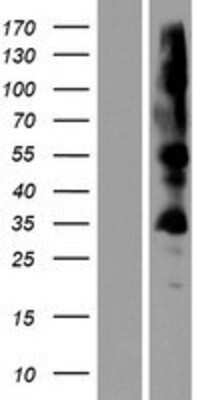 Western Blot: ZDHHC19 Overexpression Lysate [NBP2-08581]