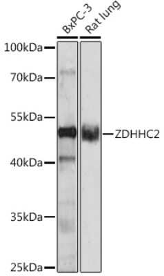 Western Blot: ZDHHC2 AntibodyAzide and BSA Free [NBP2-93085]