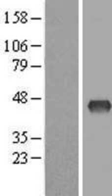 Western Blot: ZDHHC2 Overexpression Lysate [NBL1-18004]