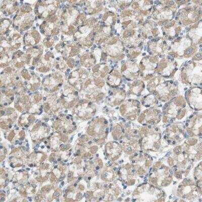 Immunohistochemistry-Paraffin: ZDHHC20 Antibody [NBP1-82046]