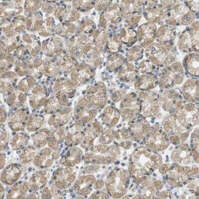 Immunohistochemistry-Paraffin: ZDHHC20 Antibody [NBP1-82047]