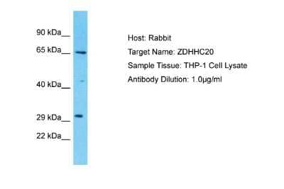 Western Blot: ZDHHC20 Antibody [NBP2-86409]