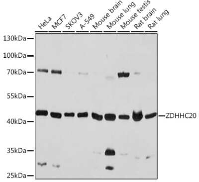 Western Blot: ZDHHC20 AntibodyAzide and BSA Free [NBP2-94488]