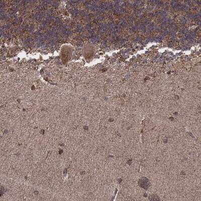 Immunohistochemistry-Paraffin: ZDHHC21 Antibody [NBP2-57201]