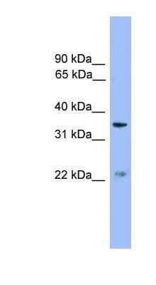 Western Blot: ZDHHC21 Antibody [NBP1-57049]