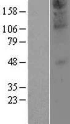 Western Blot: ZDHHC21 Overexpression Lysate [NBP2-04950]