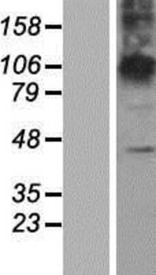 Western Blot: ZDHHC23 Overexpression Lysate [NBP2-05120]