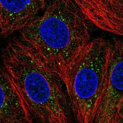 Immunocytochemistry/ Immunofluorescence: ZDHHC24 Antibody [NBP1-86450]