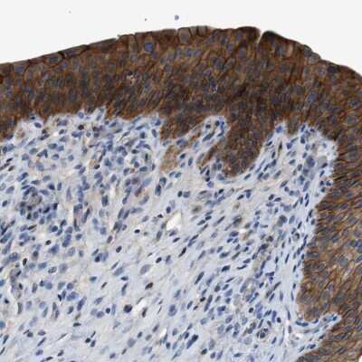 Immunohistochemistry-Paraffin: ZDHHC24 Antibody [NBP1-86450]