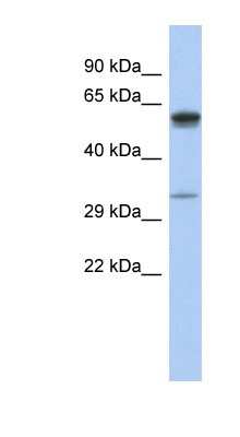 Western Blot: ZDHHC24 Antibody [NBP1-62198]