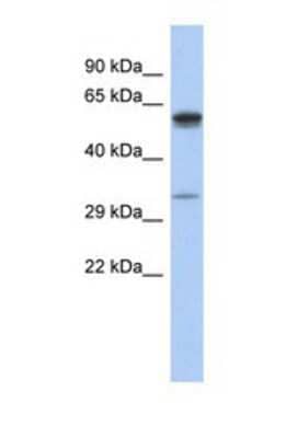 Western Blot: ZDHHC24 Antibody [NBP1-69239]