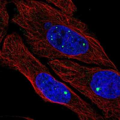 Immunocytochemistry/ Immunofluorescence: ZDHHC4 Antibody [NBP2-56184]