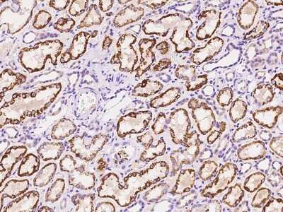 Immunohistochemistry-Paraffin: ZDHHC4 Antibody [NBP2-97818]