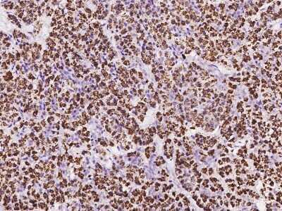 Immunohistochemistry-Paraffin: ZDHHC4 Antibody [NBP2-97818]