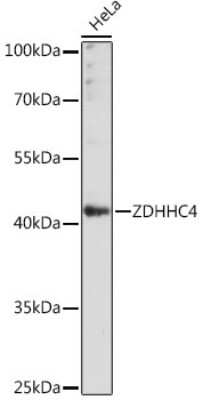 Western Blot: ZDHHC4 AntibodyAzide and BSA Free [NBP2-94486]