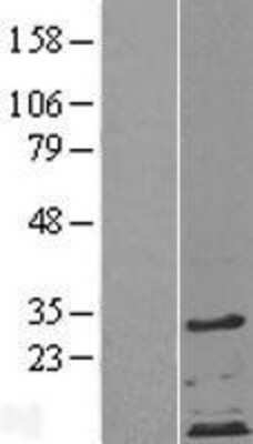 Western Blot: ZDHHC4 Overexpression Lysate [NBP2-04368]