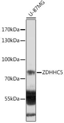 Western Blot: ZDHHC5 AntibodyAzide and BSA Free [NBP2-94470]