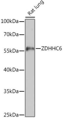 Western Blot: ZDHHC6 AntibodyAzide and BSA Free [NBP2-94489]