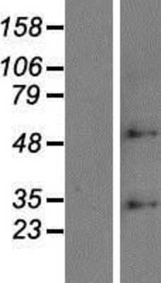 Western Blot: ZDHHC6 Overexpression Lysate [NBP2-06427]