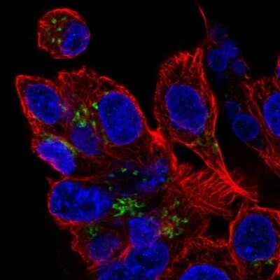 Immunocytochemistry/ Immunofluorescence: ZDHHC7 Antibody [NBP2-32486]