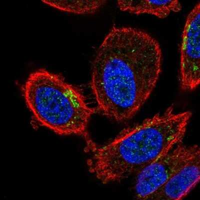 Immunocytochemistry/ Immunofluorescence: ZDHHC7 Antibody [NBP2-56799]