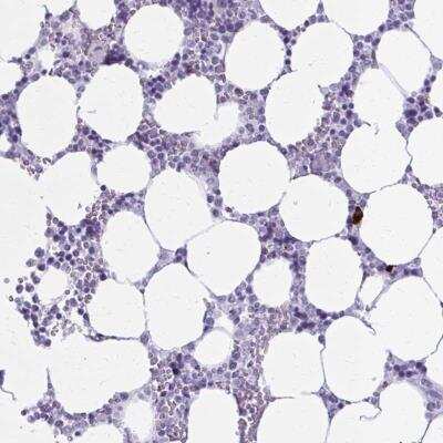 Immunohistochemistry: ZDHHC7 Antibody [NBP2-33884]