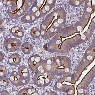 Immunohistochemistry-Paraffin: ZDHHC7 Antibody [NBP2-32486]