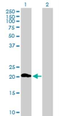 Western Blot: ZDHHC7 Antibody [H00055625-B01P]