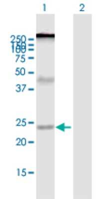 Western Blot: ZDHHC7 Antibody [H00055625-B01P]