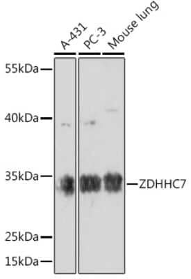 Western Blot: ZDHHC7 AntibodyAzide and BSA Free [NBP2-94487]