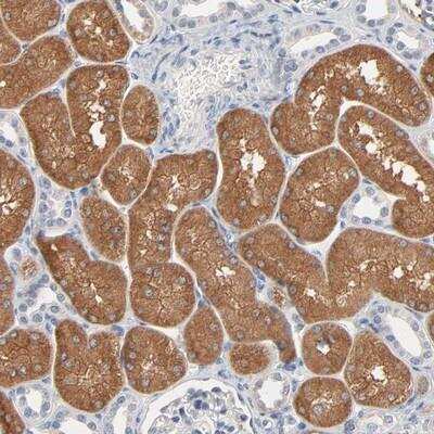 Immunohistochemistry-Paraffin: ZDHHC8 Antibody [NBP1-81418]