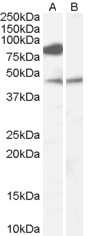 Western Blot: ZDHHC8 Antibody [NB100-57849]