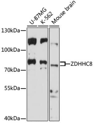 Western Blot: ZDHHC8 AntibodyAzide and BSA Free [NBP2-93430]