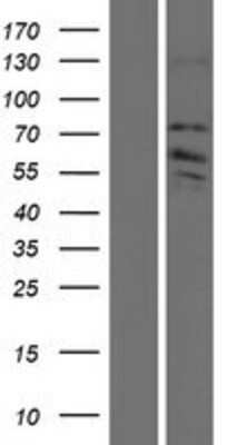 Western Blot: ZDHHC8 Overexpression Lysate [NBP2-10261]