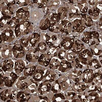 Immunohistochemistry-Paraffin: ZDHHC9 Antibody [NBP1-84499]