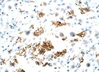 Immunohistochemistry-Paraffin: ZDHHC9 Antibody [NBP3-12368]