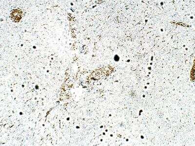 Immunohistochemistry-Paraffin: ZDHHC9 Antibody [NBP3-12368]