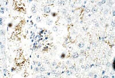 Immunohistochemistry-Paraffin: ZDHHC9 Antibody [NBP3-12368]