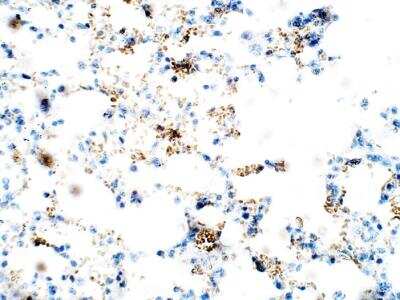 Immunohistochemistry-Paraffin: ZDHHC9 Antibody [NBP3-12368]