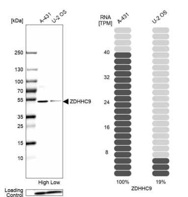 Western Blot: ZDHHC9 Antibody [NBP1-84499]