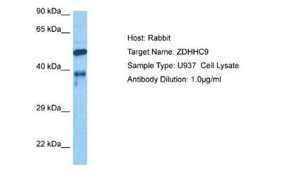 Western Blot: ZDHHC9 Antibody [NBP2-83797]