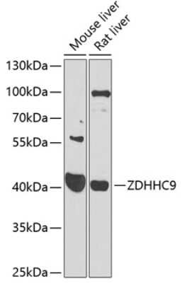 Western Blot: ZDHHC9 AntibodyBSA Free [NBP2-93686]