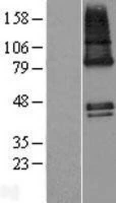 Western Blot: ZDHHC9 Overexpression Lysate [NBL1-18008]