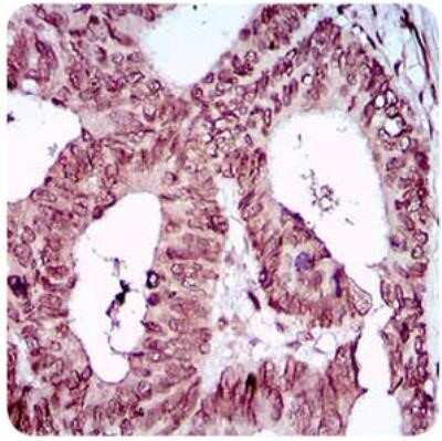 Immunohistochemistry: ZEB1 Antibody (2A8A6) - Azide and BSA Free [NBP2-81015]